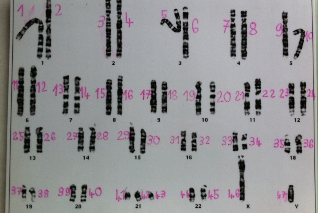 Ein Karyogramm mit 47 Chromosomen, Bild: Katja de Bragança Ein Karyogramm mit 47 Chromosomen